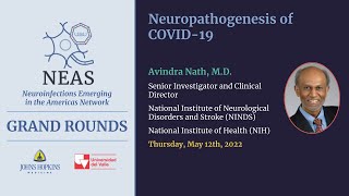 NEAS Grand Round May 2022 COVID 19 Neuropatogenesis by Avi Nath