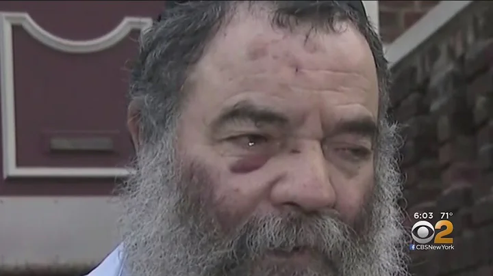 Brooklyn Brick Attack Victim Speaks Out