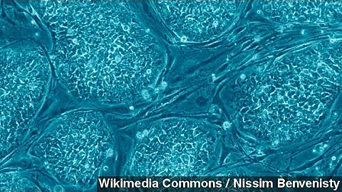 Scientists Create Stem Cells From Adult Skin Cells