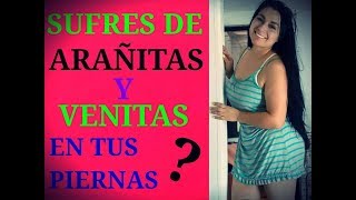 Piernas rojas delgadas venas en las