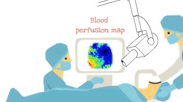 PerfusionCam: A camera-based blood flow imaging system