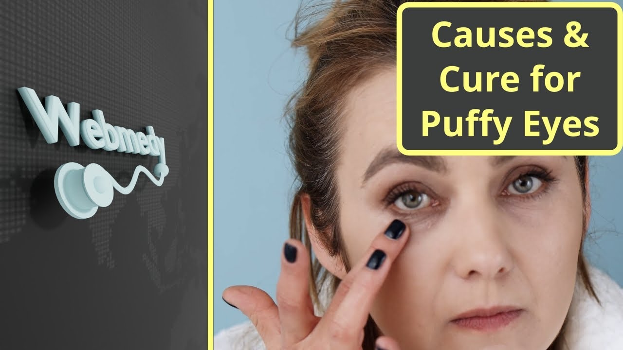 What Causes Puffy Eyes And Face In The Morning