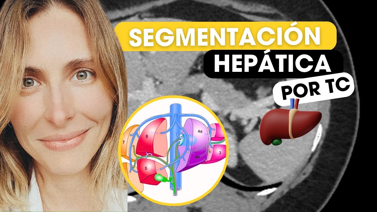 Aprende segmentación hepática en menos de 10´ 😎