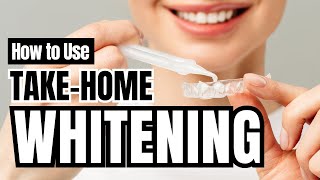 How to Use Take-Home Whitening | Dr. Alexis Washington at Washington Metro Dental in Washington, DC
