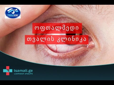 თვალის კლინიკა ოფთალმედი