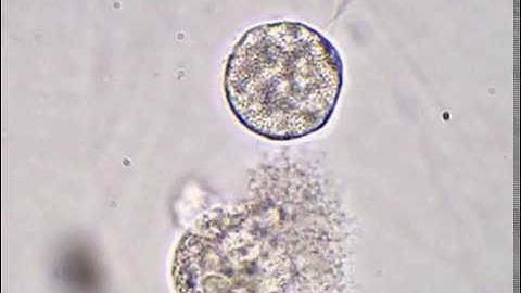 Mimivirus explosion 2