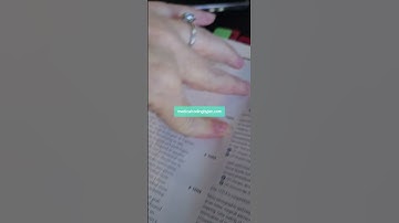 Integumentary Case in 30 second Medical Coder exam Process tips :#freecourses  #cpc  #medicalcoder