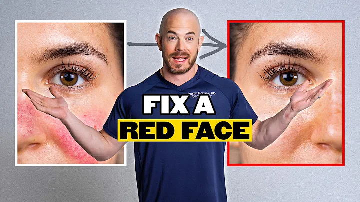 Top Dermatologist's Advice for Rosacea & Sensitive Skin