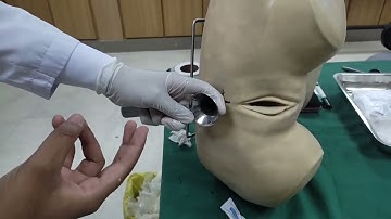 digital rectal examination and proctoscopy