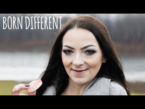 I Lost All My Teeth Aged 23 | BORN DIFFERENT