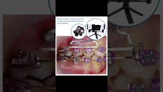 Dental photography flash light