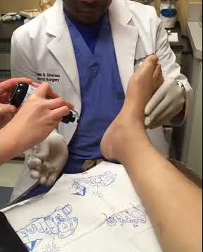 Dr. Shaheed - Plantar Fasciitis Injections