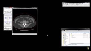 BII AsanJ automatic FAT measurement