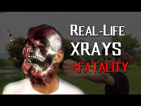 real-life-mortal-kombat-xrays-and-fatality!