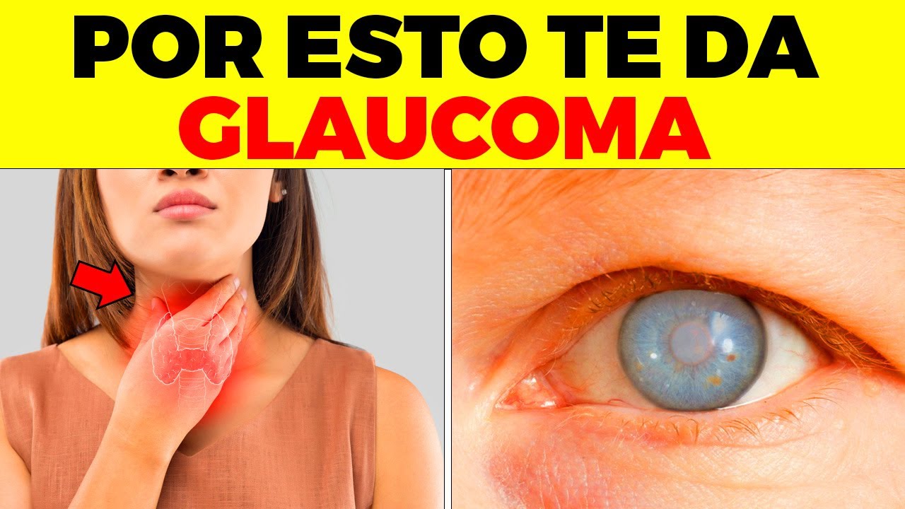 ALERTA! Por Esta Peligrosa Razón Tendrás Glaucoma, Y Nadie Te Lo Dice