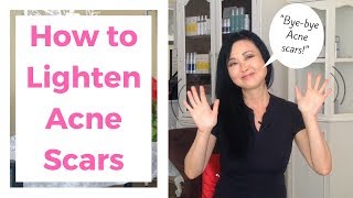 How to Lighten Acne Scars