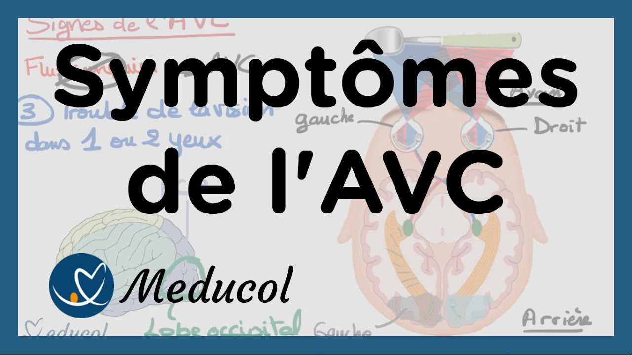 Quels sont les signes d'un AVC : AVC symptômes et AVC séquelles