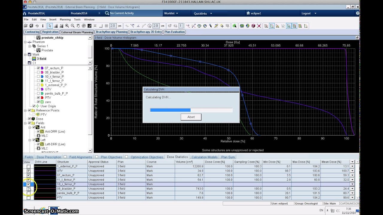 12 How to interpret a DVH YouTube