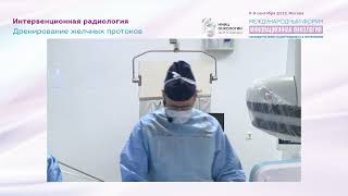 видео: Дренирование желчных протоков. Антеградная холангиоскопия + биопсия. Фотодинамическая терапия. картинка: Дренирование желчных протоков. Антеградная холангиоскопия + биопсия. Фотодинамическая терапия.