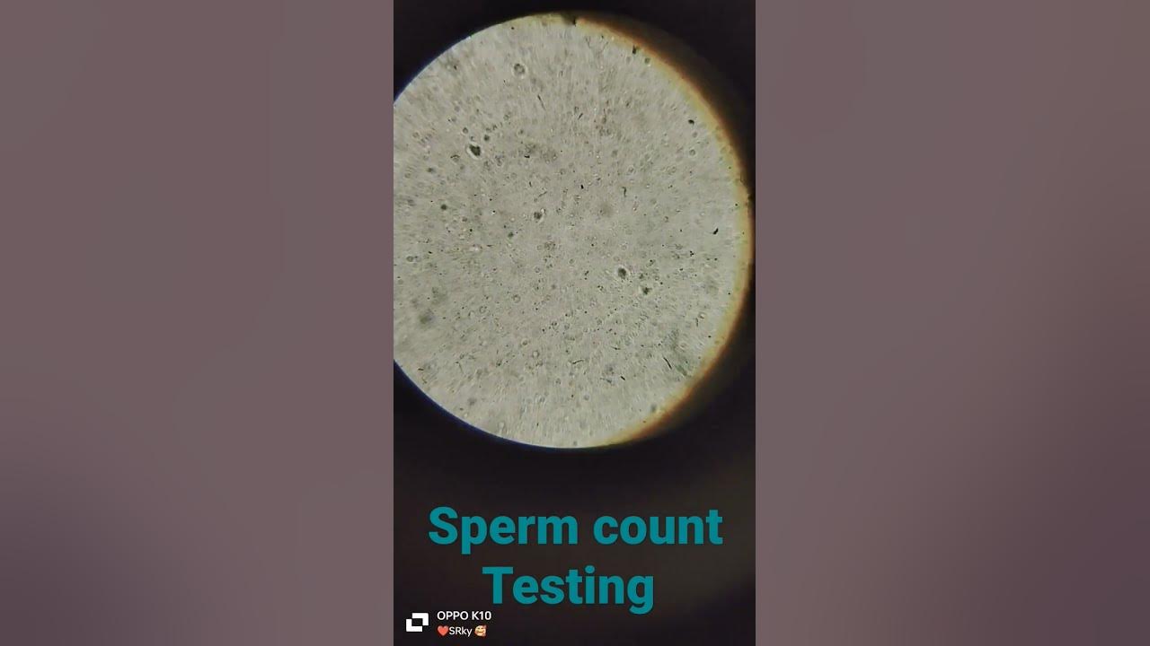 zero-sperm-count-azoospermia-microscopy-sperm-test-doctor-bams-sperm