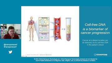 Jessica Blackburn: Detection of cell-free DNA in acute lymphoblastic leukemia samples