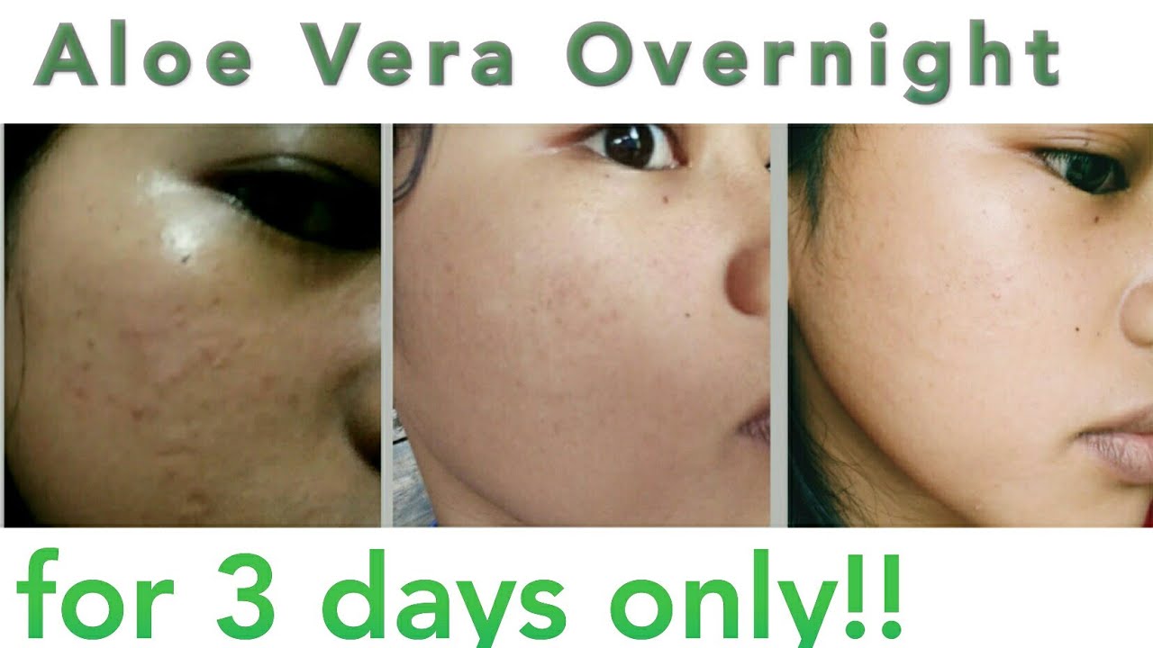 i put aloe vera on my face overnight for 3 days - YouTube