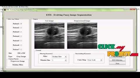 Final Year Projects 2015 | EFIS- Evolving Fuzzy Image Segmentation