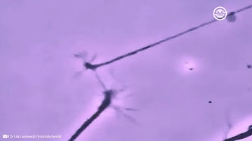 Two neurons literally sensing each other. And trying to connect.