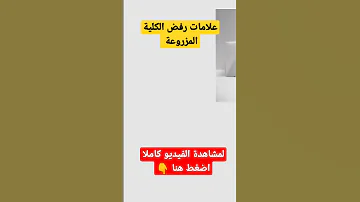 علامات رفض الكلية المزروعة 