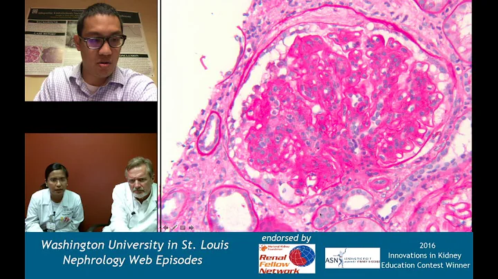 Nephrology Web Episode #021 - Renal Pathology Teaching Series (MPGN with Drs  Rodby and Charag)
