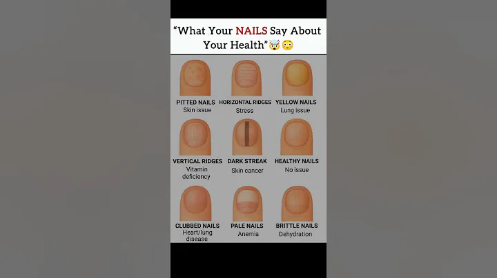 “What Your Nails Say About Your Health”#shorts​ #nails​ #healthawareness​