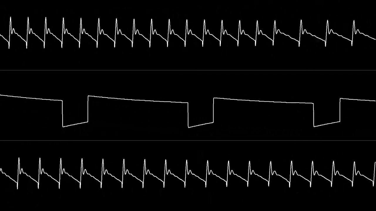 Tim Follin - "Bionic Commando (C64)" Full Soundtrack [Oscilloscope View]