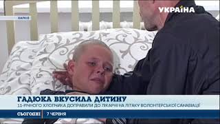 Отруйна змія вкусила 11-річного хлопчика на Харківщині