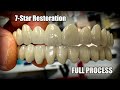 Step-By-Step Full Process of Making a Full-Mouth 7-Star Restoration with Me