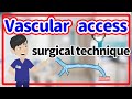 Vascular access　⭐️（Arteriovenous fistula）