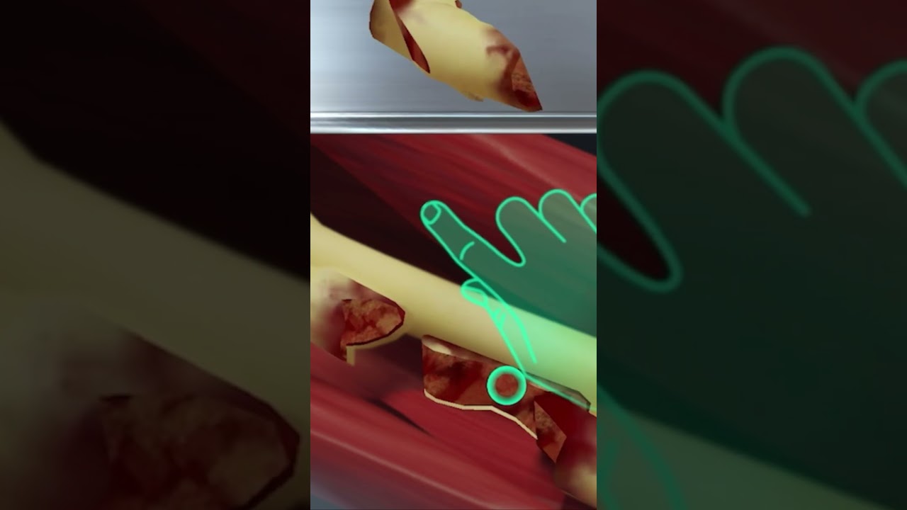 ONCOLOGICAL SURGERY - LUNG 