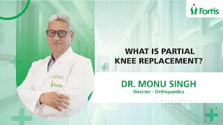 Why Partial Knee Replacements Are The Future | Dr. Monu Singh