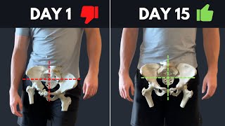 The Best Resource On The Internet For Fixing Lateral Pelvic Tilt (asymmetrical hips) screenshot 4