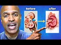How To Avoid Dialysis Naturally 