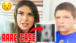 X-RAY SHOWS SOMETHING WE WERE NOT PREPARED FOR | VERY RARE CASE