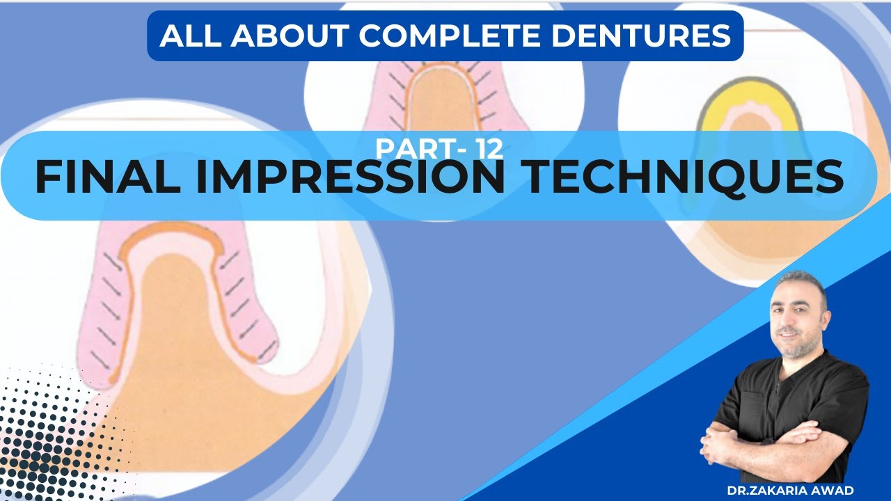 12 - تقنيات أخذ الطبعة النهائية - FINAL IMPRESSION TECHNIQUES