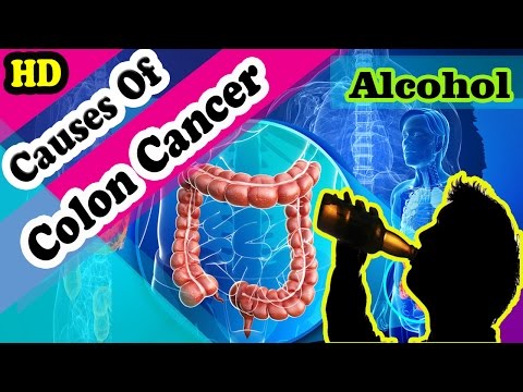 15-comon-cause-of-colon-cancer-you-should-not-ignore