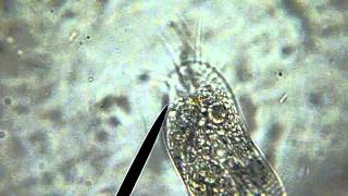 Stichotrich High Magnification
