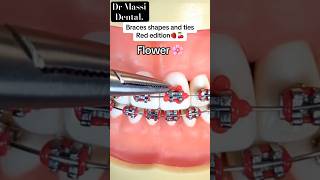 Nice FIGURES ORTHODONTIC,Braces youtubeshorts viral fashion smile dentist trending