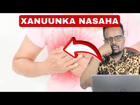 XANUUNKA KU DHACA NASAHA| CALAAMADAHAN OGOW|NAAS NUJINTA  IYO KANSARKA