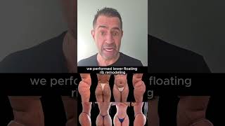 When BBL Is Not Enough: Rib Remodeling for Slim Patients Explained