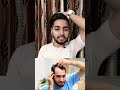 Hair Band Side Effects #shorts #hairband