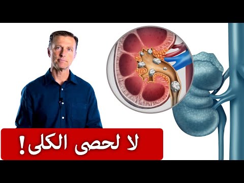 عندما تشعر بهذه العلامات فإنها حصى الكلى وعليك أن تفعل التالي فورا!