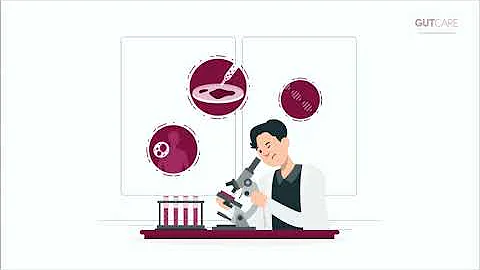 Colon Cancer Screening: Why It Matters & What to Expect | GUTCARE