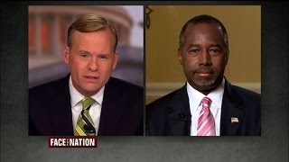 Dr. Carson: America needs to put our talents together